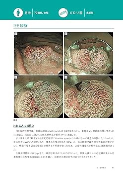 百症例式 胃の拡大内視鏡×病理対比アトラス | 拡大内視鏡×病理